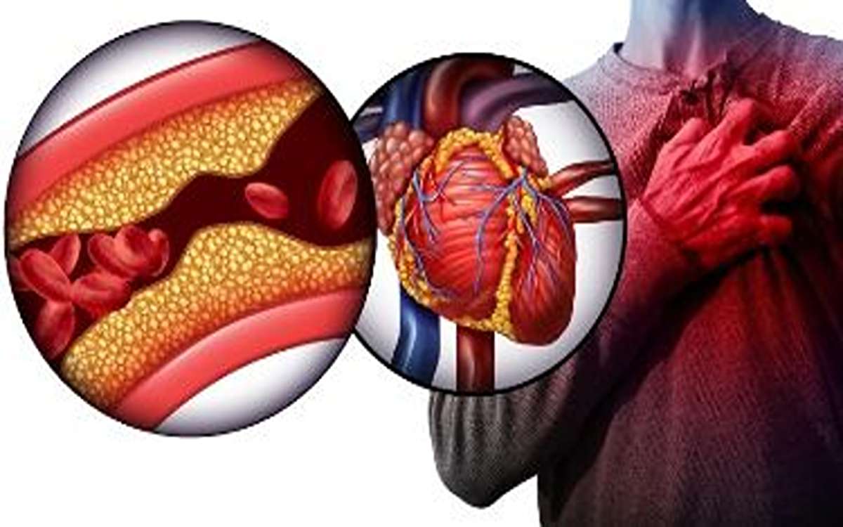 Cardiovascular Disorders